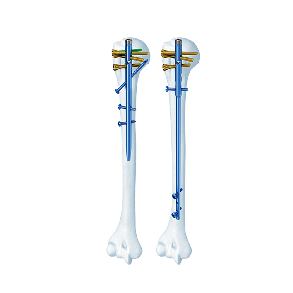 Multi-Loc Humeral Nails