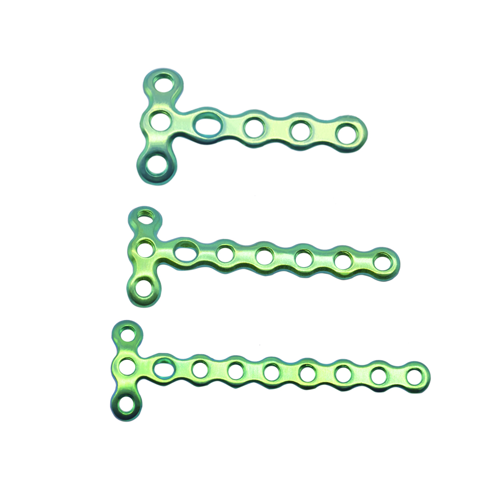 1.5mm Mini Condylar Locking Plate