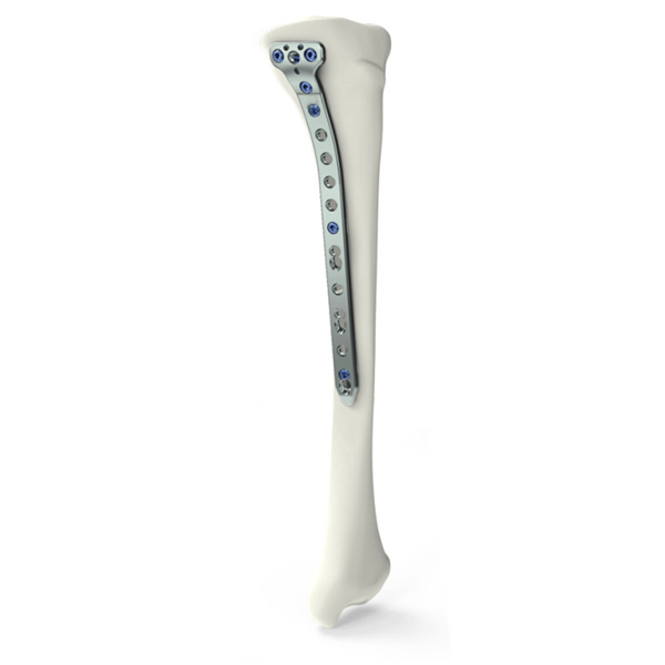 Proximal Medial Tibial Osteotomy Locking Plate