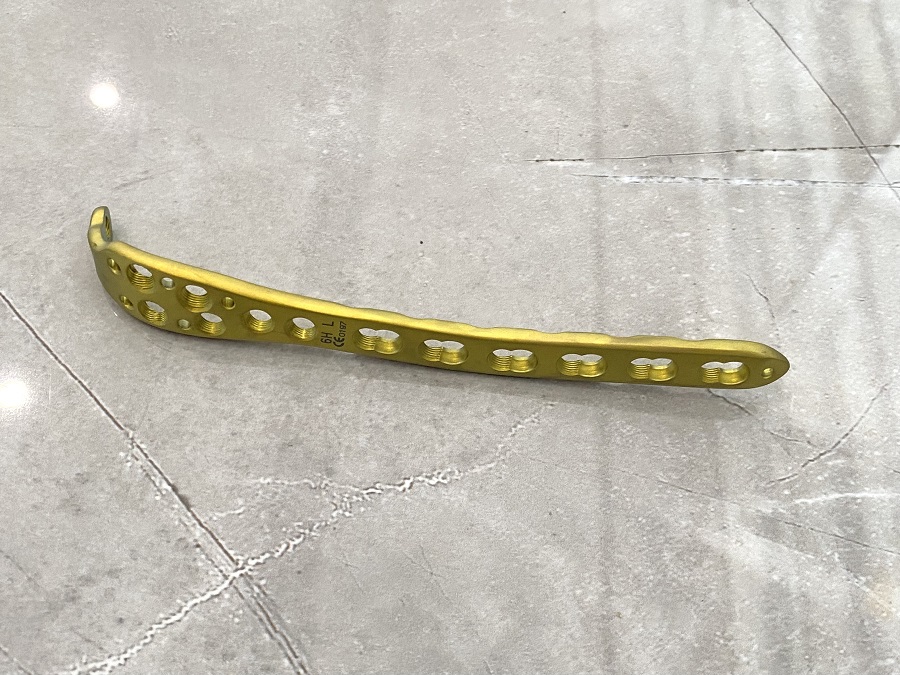 Olecranon Locking Plate