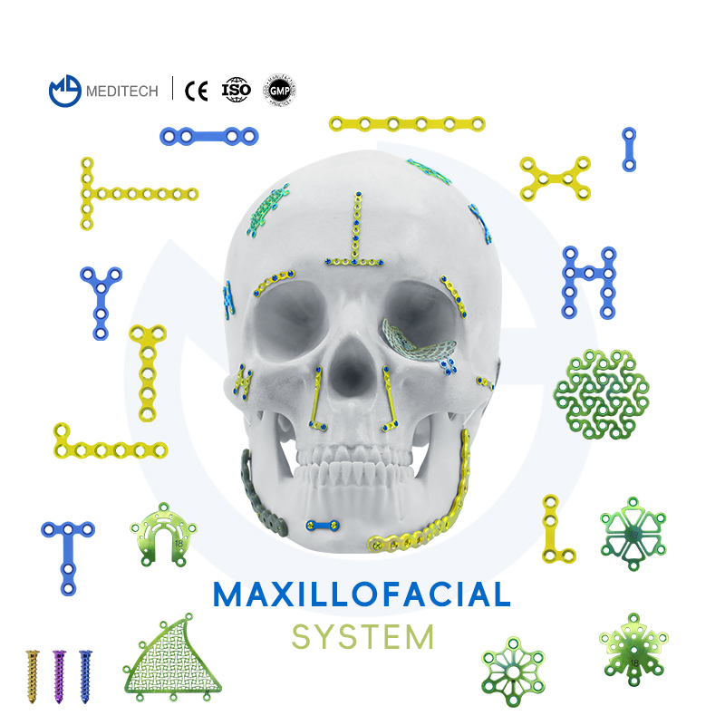 Maxillofacial Plate 1.5mm Skru Pengendalian Sendiri