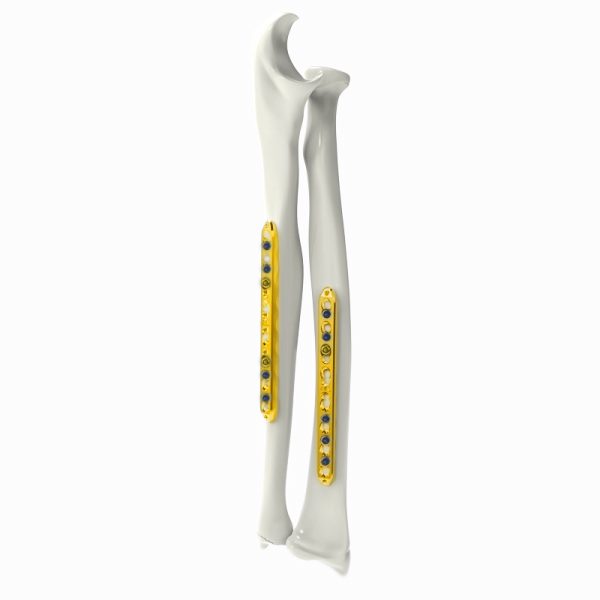 Ulna&Radius Locking Plate