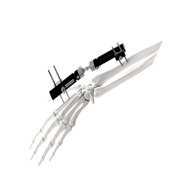 Wrist Joints External Fixator - Type A