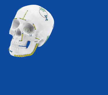 Mandible Plating System