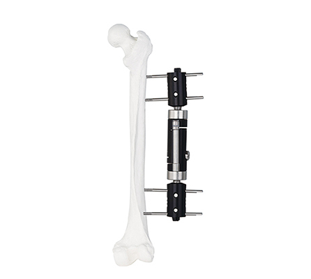 Dynamic Axial Straight Type External Fixator