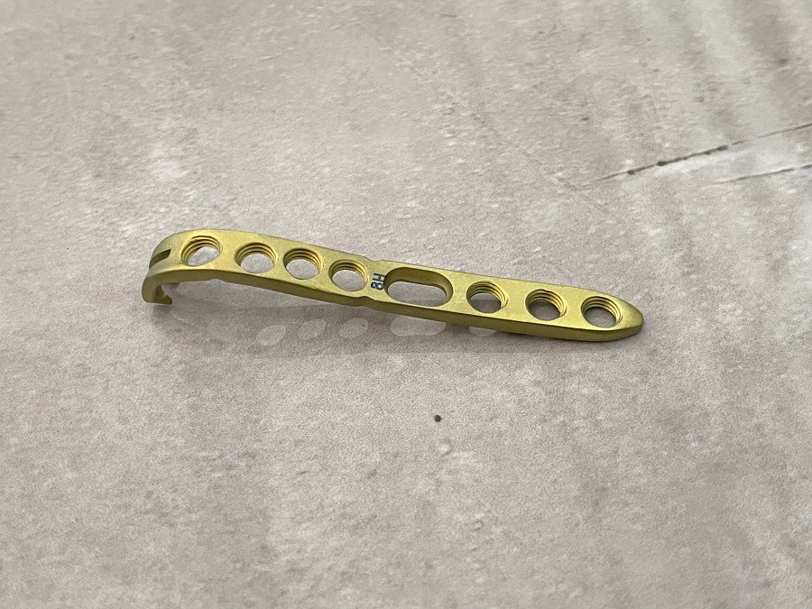 Distal Ulnar Locking Plate