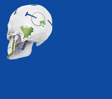 Neuro Plating System