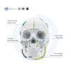Maxillofacial Plate 1.5mm Skru Pengendalian Sendiri