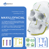 Maxillofacial Plate 1.5mm Skru Pengendalian Sendiri