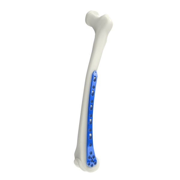 Distal Femoral Locking Plate