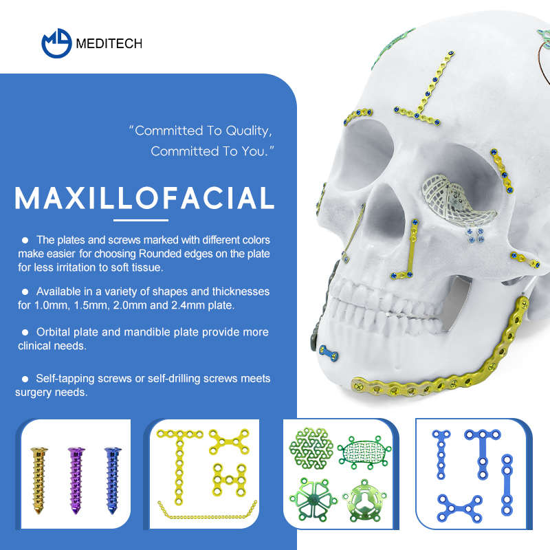 Maxillofacial Plate 1.5mm Skru Pengendalian Sendiri
