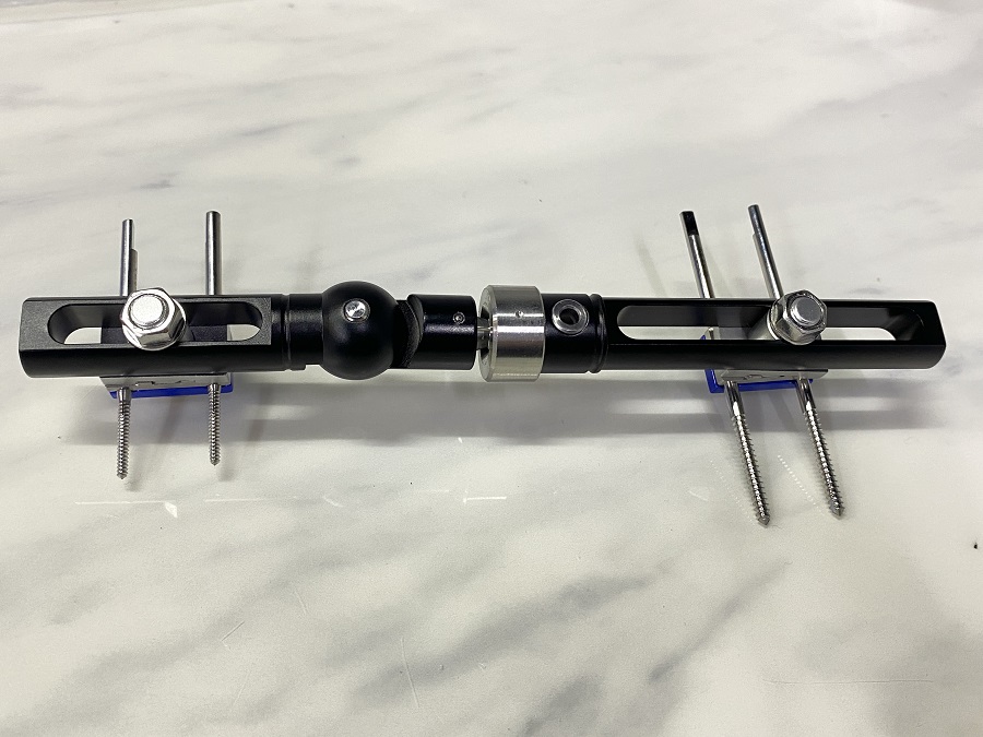 Wrist Joints External Fixator