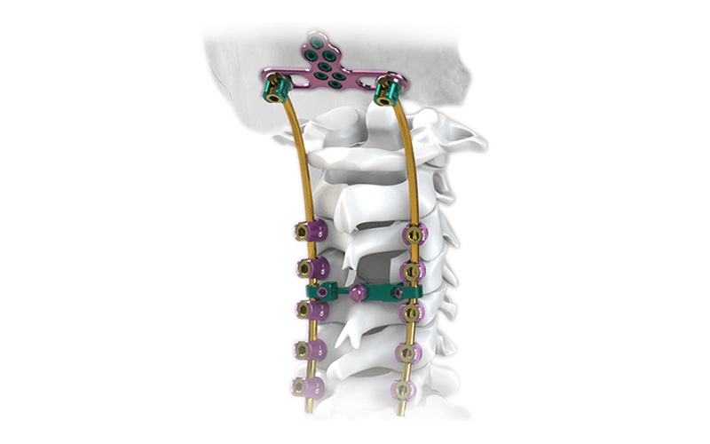 Posterior-Cervical-Screw-System
