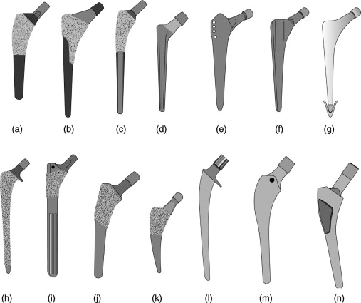 Types of femoral stem