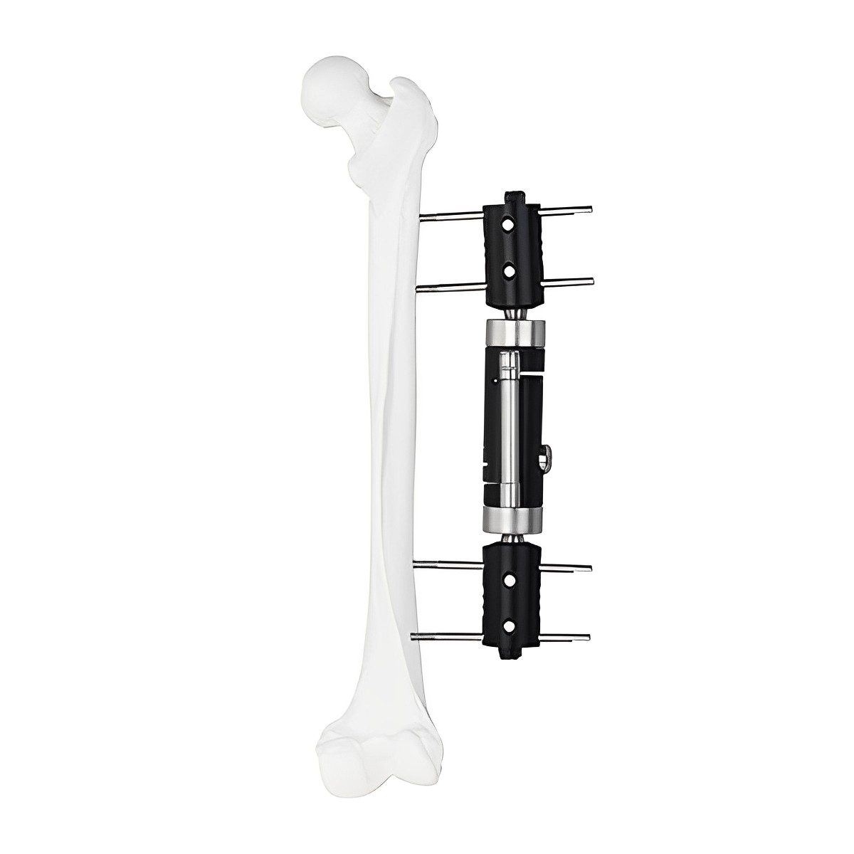 Dynamic Multiaxial Fixator