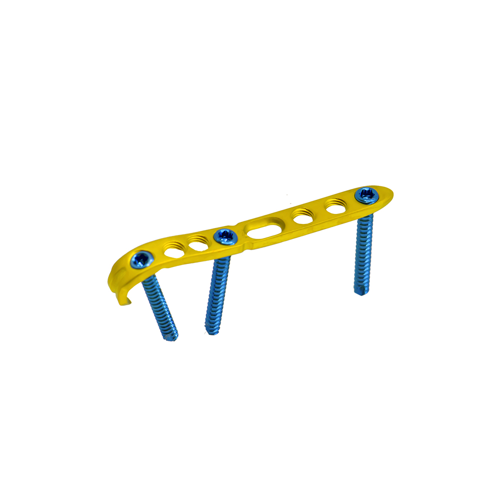 Distal Ulnar Locking Plate