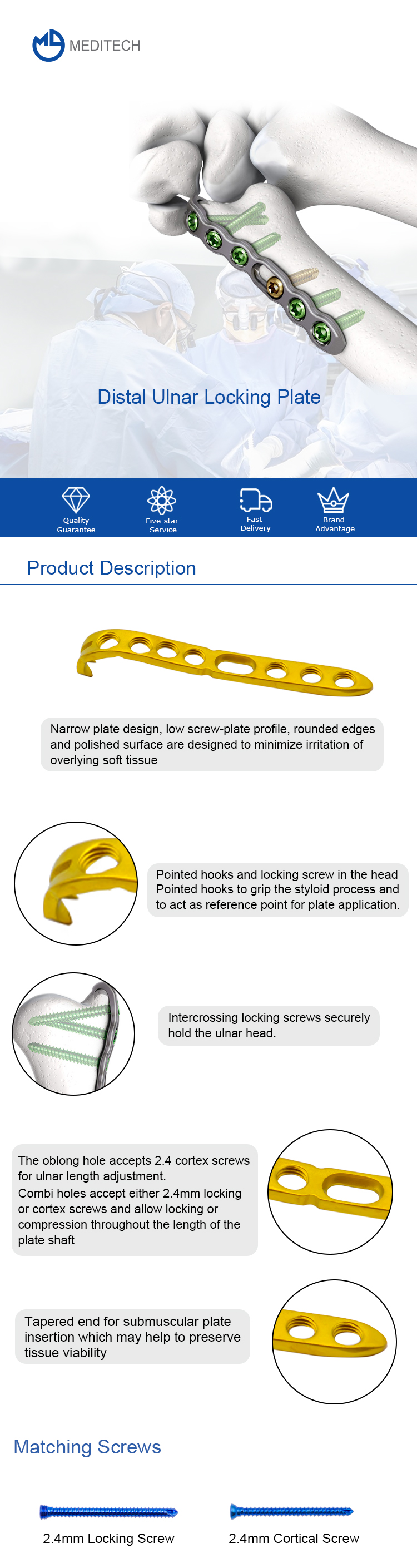 Distal Ulnar Locking Plate 