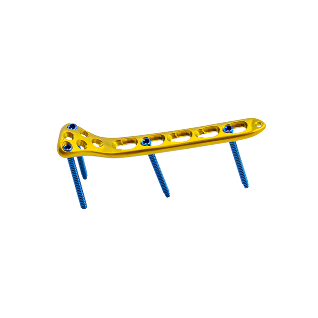 Proximal Radius Locking Plate