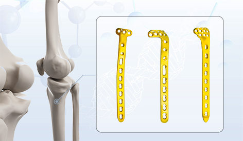 The Clinical and Commercial Synergy of the Proximal Tibial Lateral Locking Plate