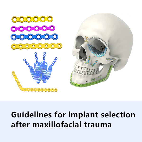 Guidelines for implant selection after maxillofacial trauma