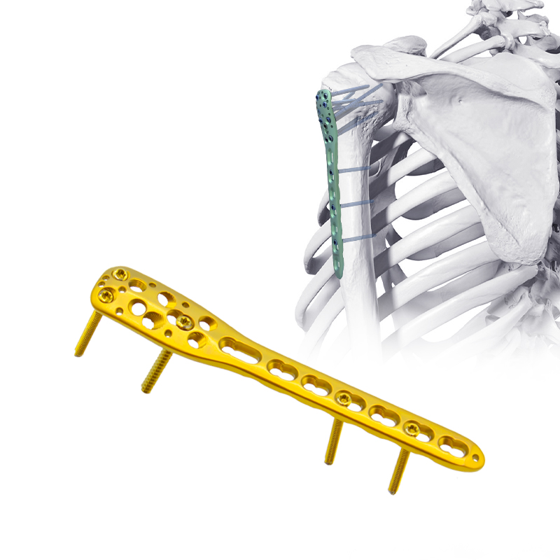 Humeral Locking Plate
