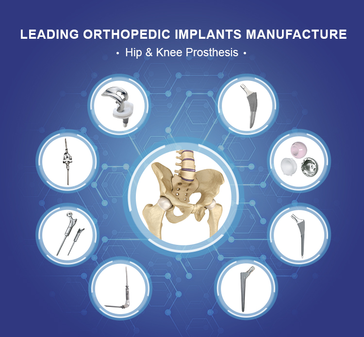 Hip prosthesis