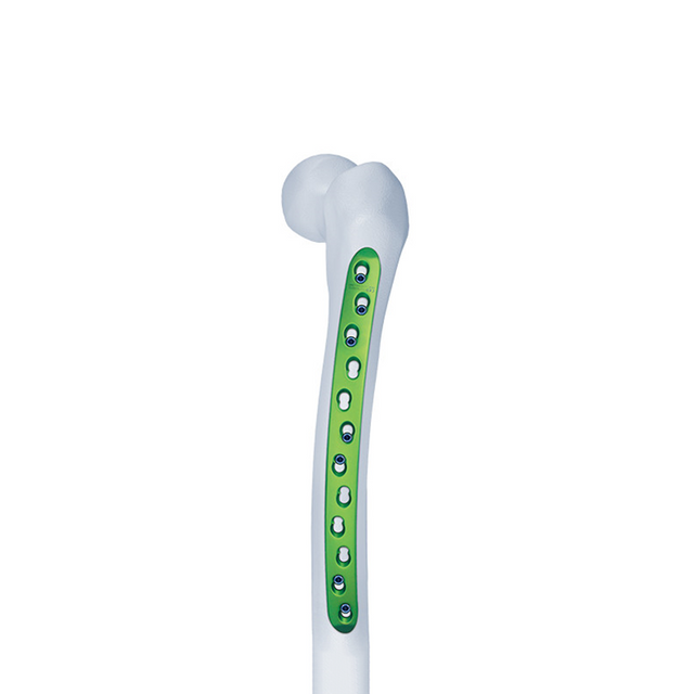 Curved Femur Locking Compression Plate(Broad)