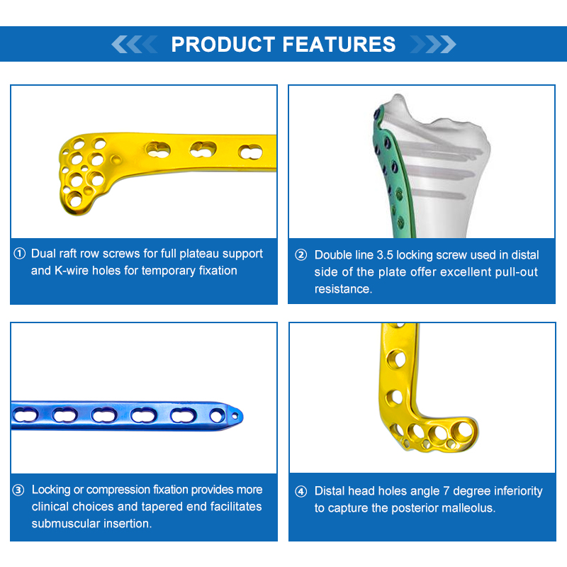 Proximal Lateral Tibial Locking Plate-II