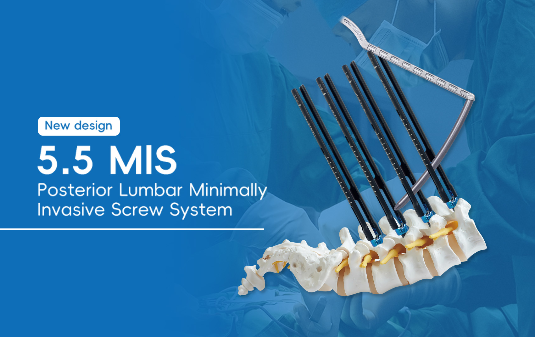 New R&D Design The Minimally Invasive Spine System (MIS)