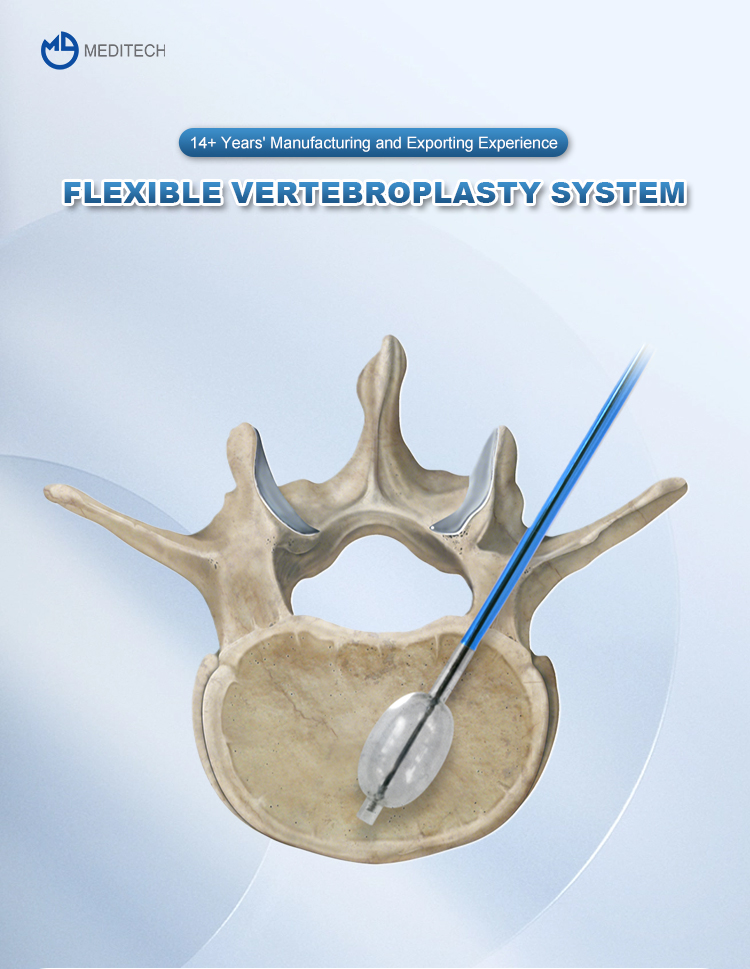 Bone Cement