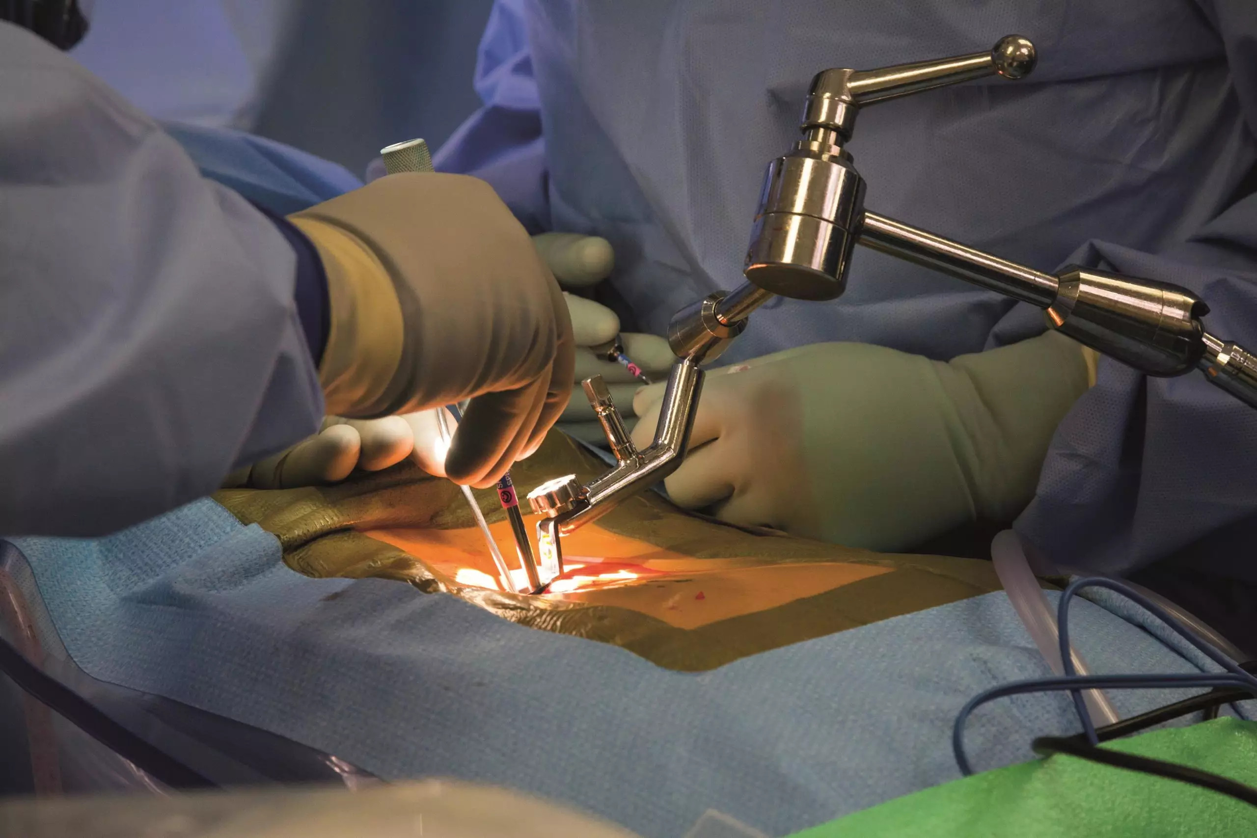 Spinal Surgery