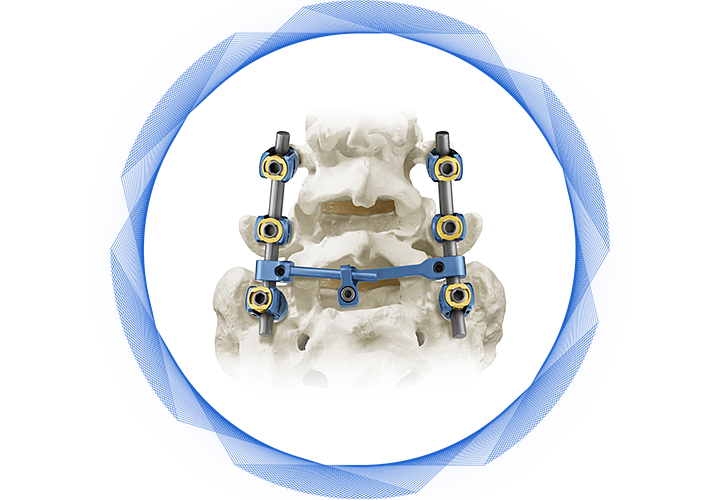 spine