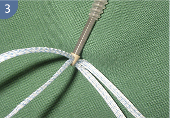 Polyethylene Suture
