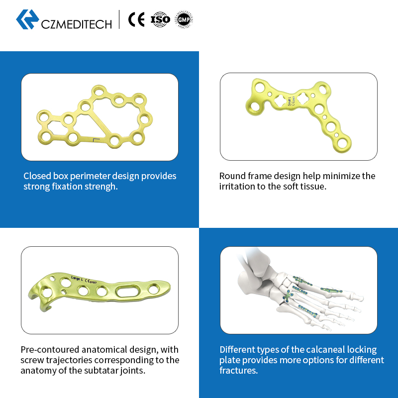 Locking Plate