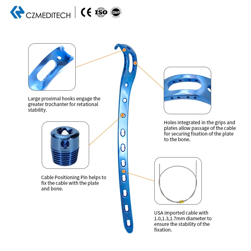 CABLE PROXIMAL FEMORAL HOOK LOCKING PLATE